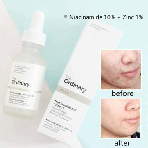 The Ordinary Niacinamide 10% + Zinc 1% – 30ml (100%) Orignal | Free Shipping | Cash on Delivery